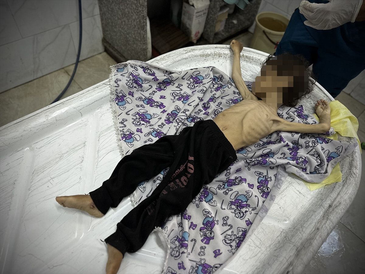 Gazzede Gıda Krizi: Bir Çocuğun Daha Yaşam Mücadelesi Son Buldu